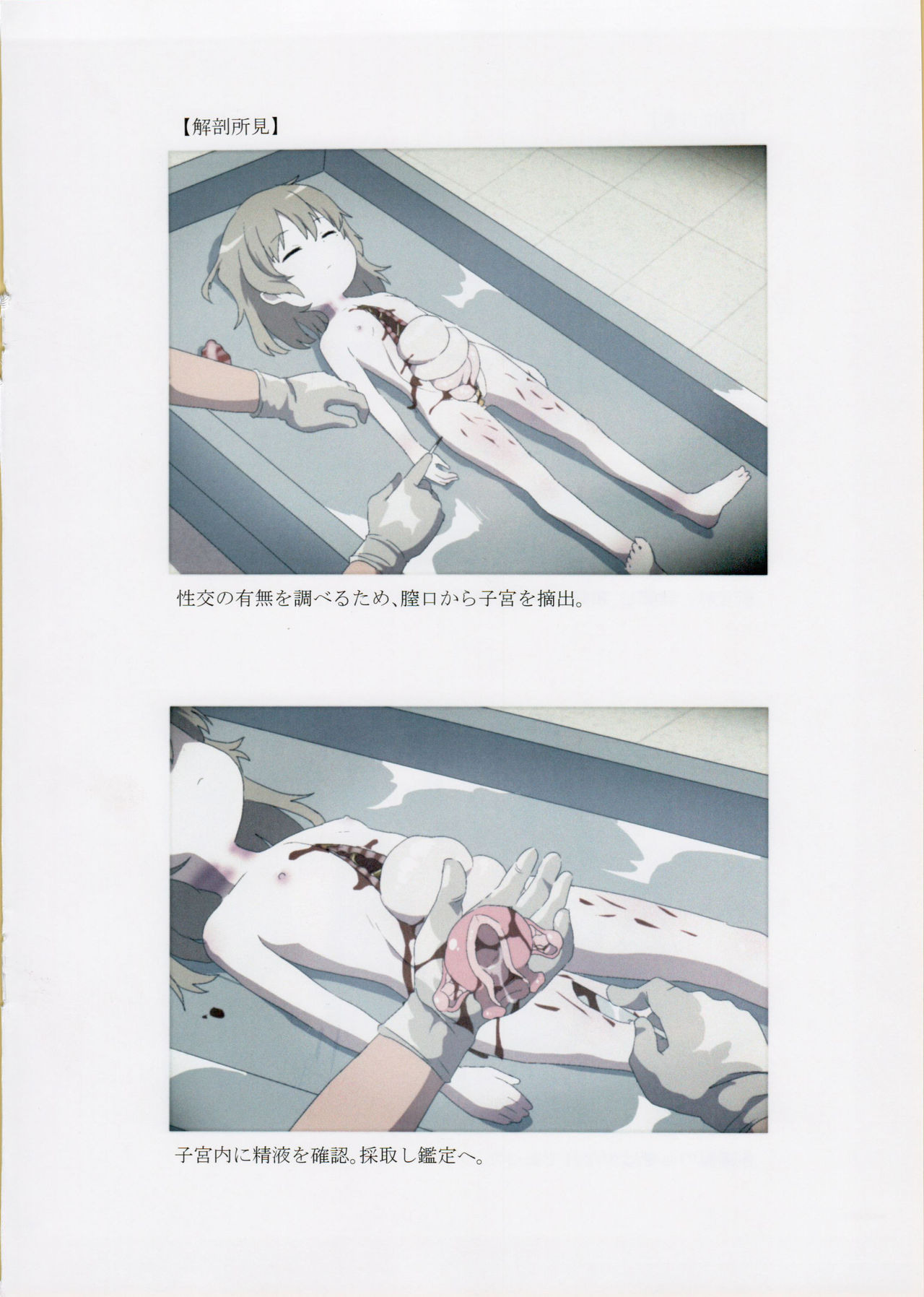 Nishiogikubo Shoujo Satsugai Jiken Shihou Kaibou Kiroku page 7 full