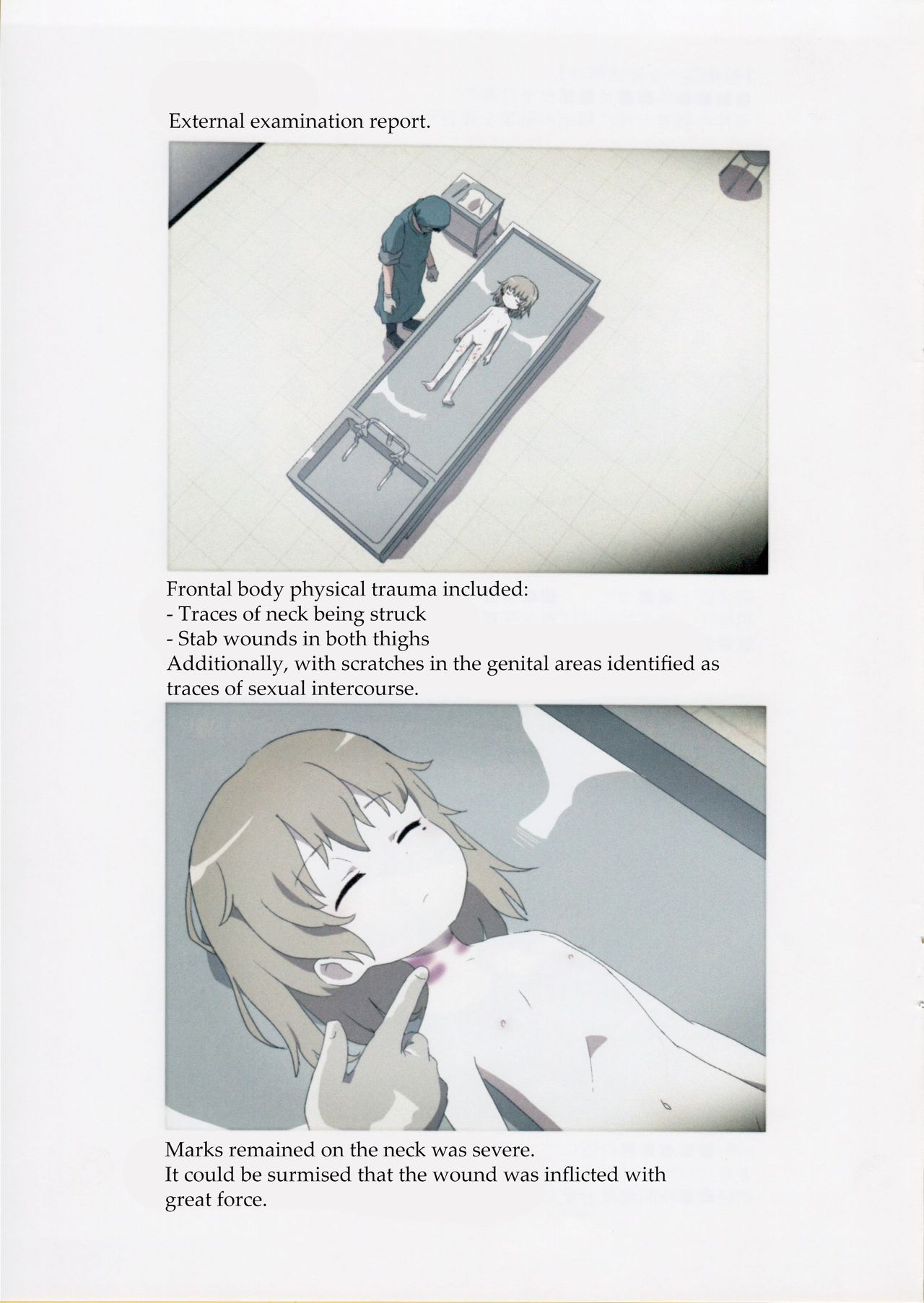 Nishiogikubo Shoujo Satsugai Jiken Shihou Kaibou Kiroku | Nishi-Ogikubo Girl Murder Case Judicial Autopsy Report page 4 full