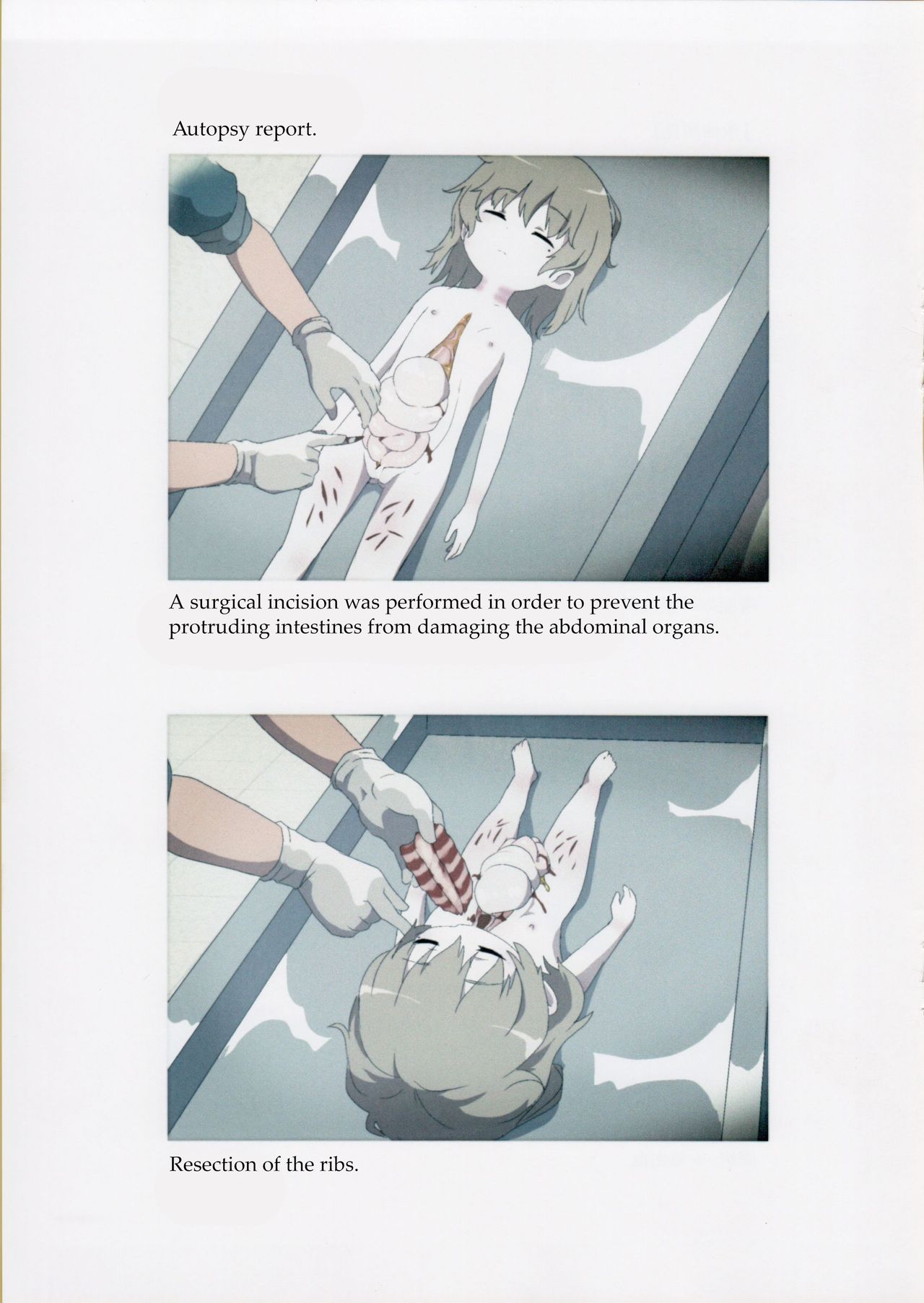 Nishiogikubo Shoujo Satsugai Jiken Shihou Kaibou Kiroku | Nishi-Ogikubo Girl Murder Case Judicial Autopsy Report page 6 full