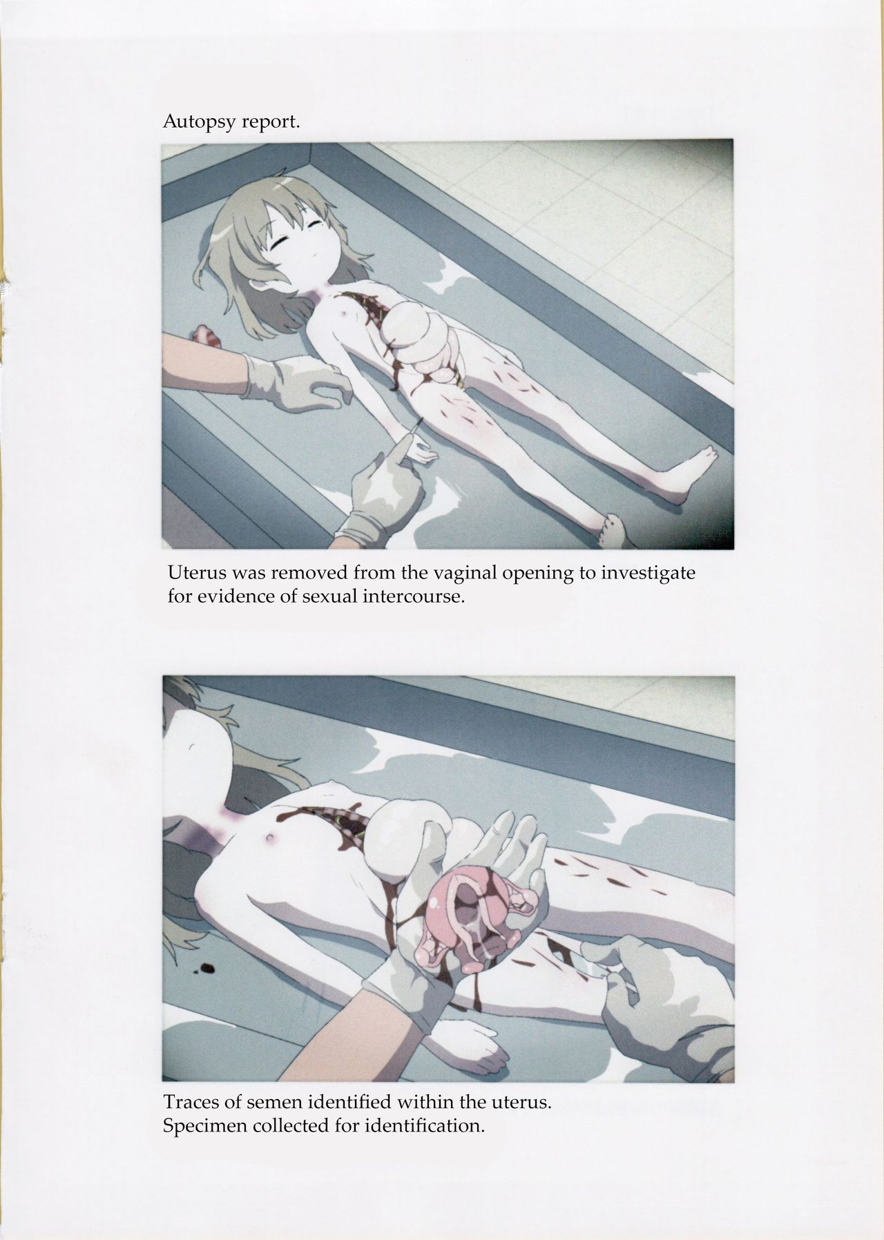 Nishiogikubo Shoujo Satsugai Jiken Shihou Kaibou Kiroku | Nishi-Ogikubo Girl Murder Case Judicial Autopsy Report page 7 full