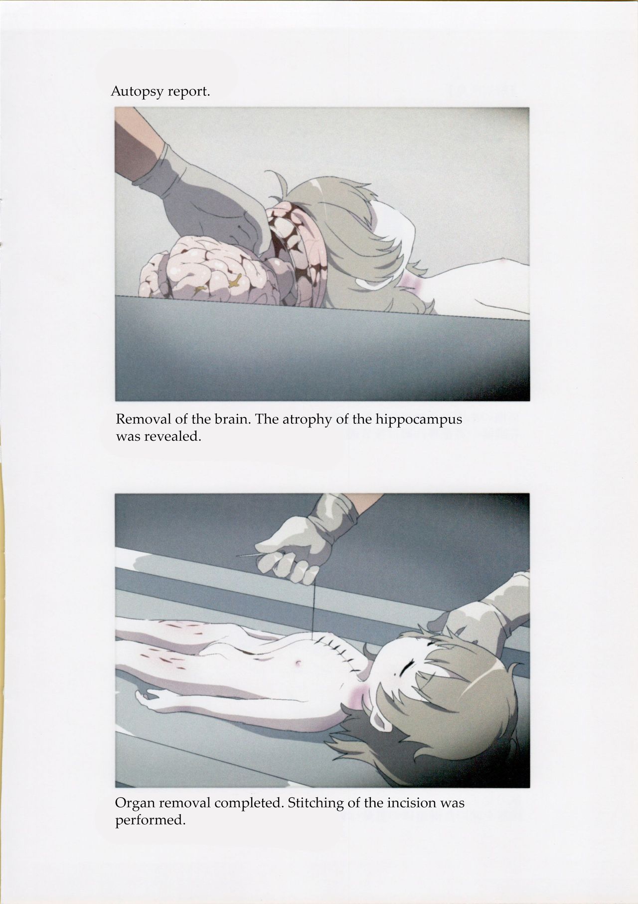 Nishiogikubo Shoujo Satsugai Jiken Shihou Kaibou Kiroku | Nishi-Ogikubo Girl Murder Case Judicial Autopsy Report page 9 full